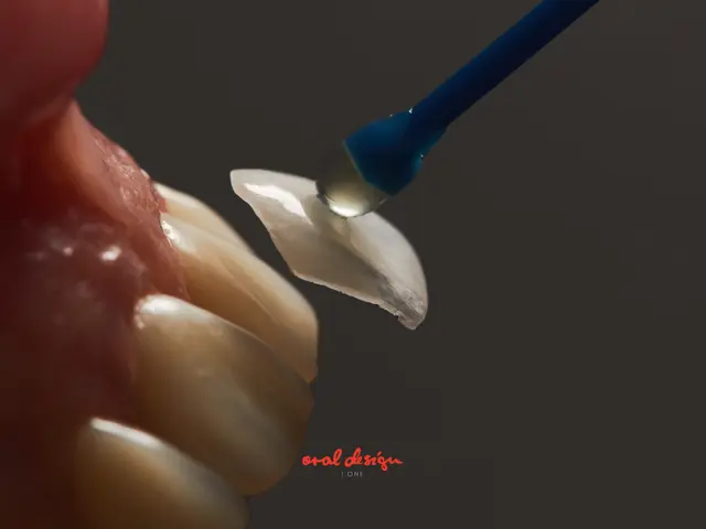 什么是 ZERONATE?面向海外患者的完整指南